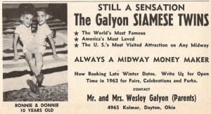 Vintage ad with black-and-white photo ad of young conjoined twins Ronnie and Donnie on a bed, promoting event appearances and contact info.