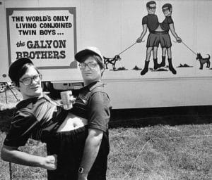 Two conjoined twin men stand outdoors by a sign reading The Worlds Only Living Conjoined Twin Boys, with art of them in the background showing them walking two dogs.